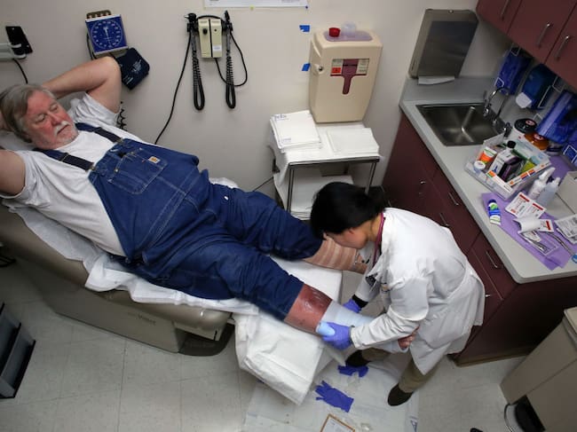Paul Haskins, who has venous insufficiency is tended to by nurse practitioner Yuwen Liao at the San Mateo Medical Center in San Mateo, Ca., on Thurs. March 23, 2017. (Michael Macor/Getty Images)