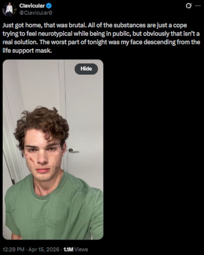 El influencer Clavicular tuitea en X tras su vuelta a casa el 15 de abril de 2026 / X